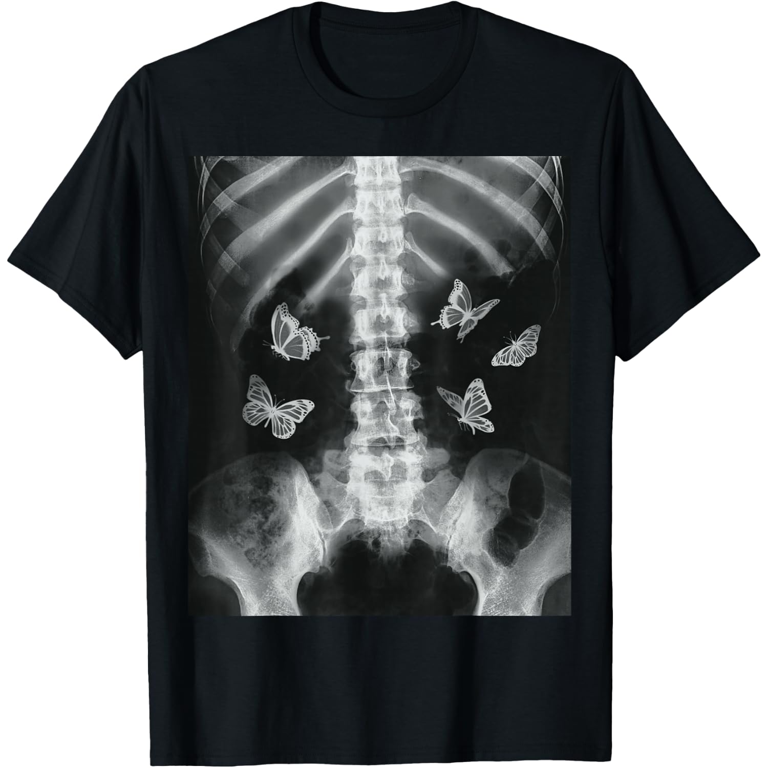 Egirl Skeleton Xray Butterfly Harajuku y2k Dark Edgy Grunge T-Shirt