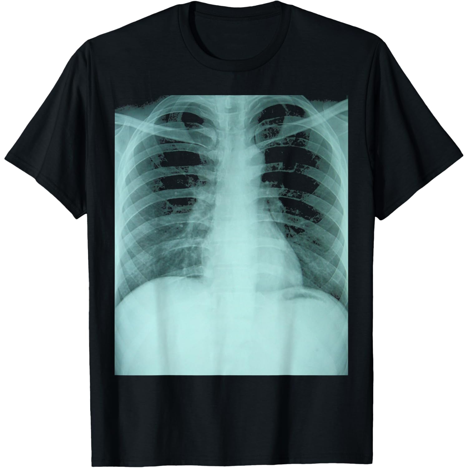 X-Ray Shirt